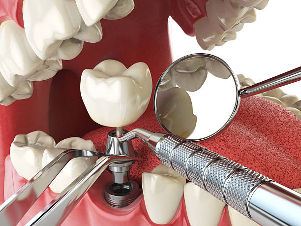 Best Same-Day Emergency Dental Services in New Burlington, OH